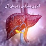آلرژی صفرایی و درمان آن