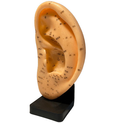 مولاژ طب سوزنی گوش